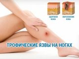 Трофические язвы на ногах: что это и как с ними бороться?